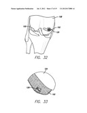 METHOD AND DEVICE FOR AMELIORATING JOINT CONDITIONS AND DISEASES diagram and image