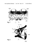 METHODS AND DEVICES FOR PATIENT-SPECIFIC ACETABULAR COMPONENT ALIGNMENT IN     TOTAL HIP ARTHROPLASTY diagram and image