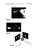 METHODS AND DEVICES FOR PATIENT-SPECIFIC ACETABULAR COMPONENT ALIGNMENT IN     TOTAL HIP ARTHROPLASTY diagram and image