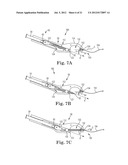 SUTURE SYSTEM AND ASSEMBLY INCLUDING A TUBULAR LEADER HAVING A CLASP diagram and image