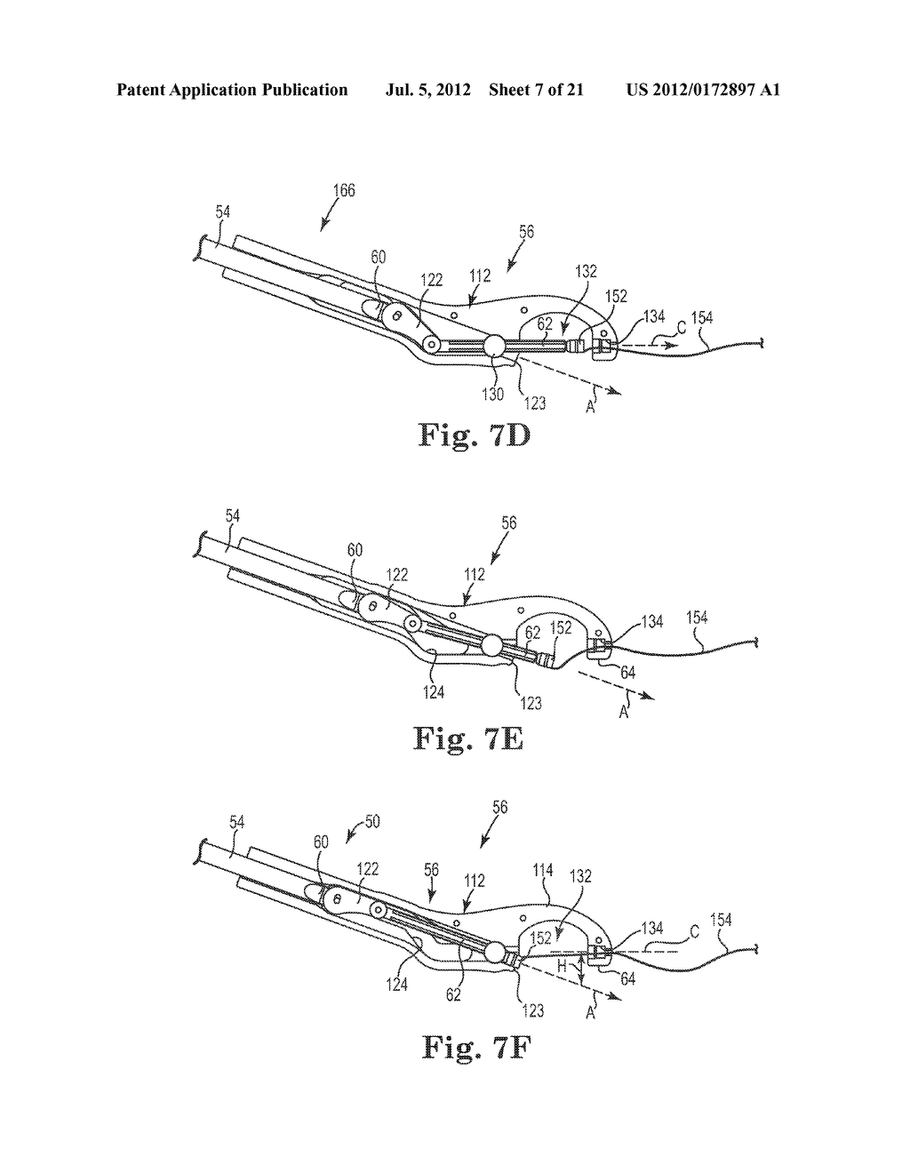 SUTURE SYSTEM AND ASSEMBLY INCLUDING A TUBULAR LEADER HAVING A CLASP - diagram, schematic, and image 08