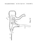 SUTURE SYSTEM AND ASSEMBLY INCLUDING A TUBULAR LEADER HAVING A CLASP diagram and image