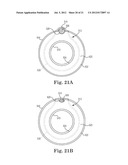 SUTURE SYSTEM AND ASSEMBLY INCLUDING A TUBULAR LEADER HAVING A CLASP diagram and image