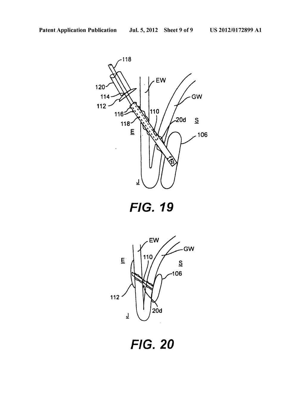 A GASTROINTESTINAL TRACT - diagram, schematic, and image 10