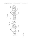 Tissue Removal Apparatus and Method of Manufacturing Same diagram and image