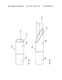 Tissue Removal Apparatus and Method of Manufacturing Same diagram and image