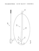 Tissue Removal Apparatus and Method of Manufacturing Same diagram and image