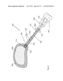 Tissue Removal Apparatus and Method of Manufacturing Same diagram and image