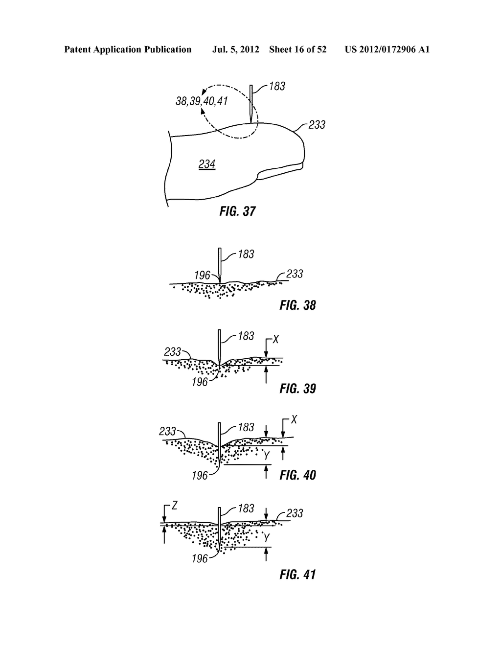 Tissue penetration device - diagram, schematic, and image 17