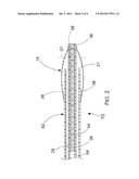 OCCLUSION DEVICE diagram and image