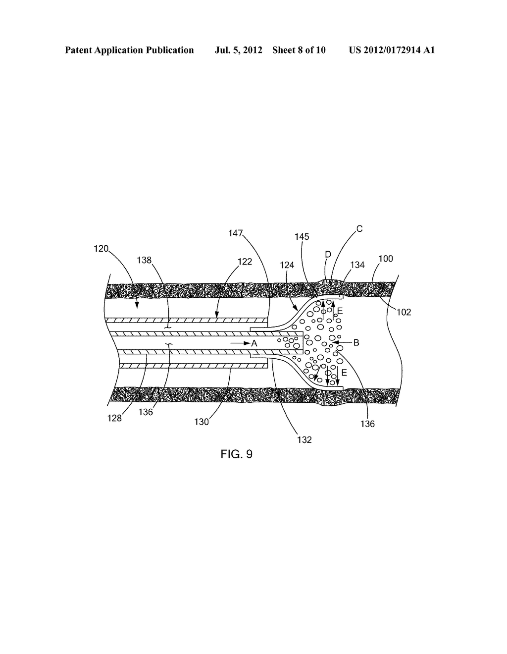 OCCLUSION DEVICE - diagram, schematic, and image 09