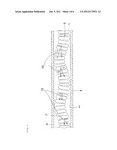 EMBOLIZATION COIL diagram and image