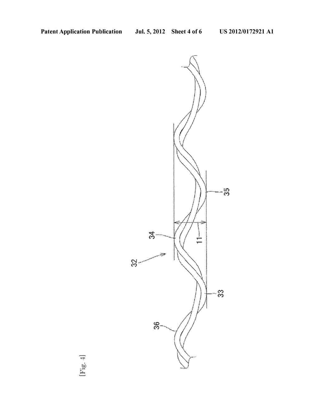 EMBOLIZATION COIL - diagram, schematic, and image 05