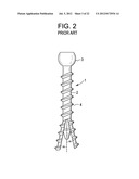 Expansion Screw Bone Tamp diagram and image