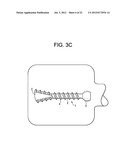 Expansion Screw Bone Tamp diagram and image