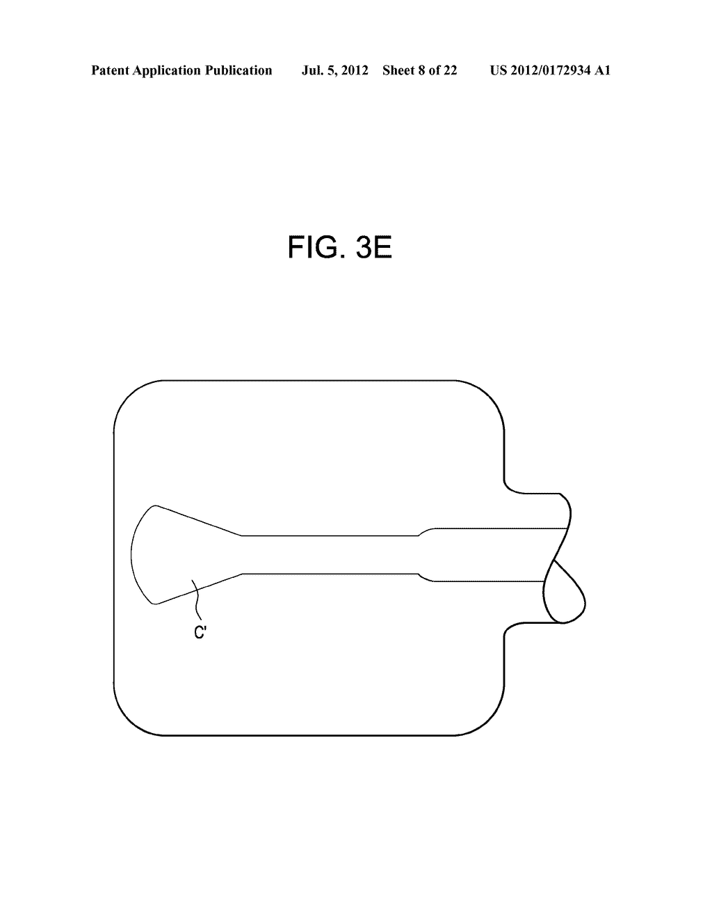 Expansion Screw Bone Tamp - diagram, schematic, and image 09