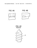 Expansion Screw Bone Tamp diagram and image