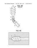 Expansion Screw Bone Tamp diagram and image