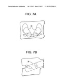 Expansion Screw Bone Tamp diagram and image