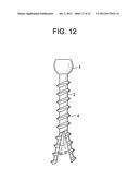 Expansion Screw Bone Tamp diagram and image