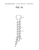 Expansion Screw Bone Tamp diagram and image