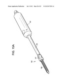 Expansion Screw Bone Tamp diagram and image