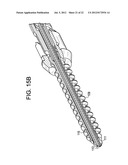 Expansion Screw Bone Tamp diagram and image