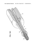 Expansion Screw Bone Tamp diagram and image