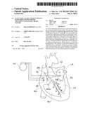 ACTIVE IMPLANTABLE MEDICAL DEVICE WITH ATRIAL PACING FOR THE TREATMENT OF     DIASTOLIC HEART FAILURE diagram and image