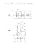 ACTIVE IMPLANTABLE MEDICAL DEVICE WITH ATRIAL PACING FOR THE TREATMENT OF     DIASTOLIC HEART FAILURE diagram and image