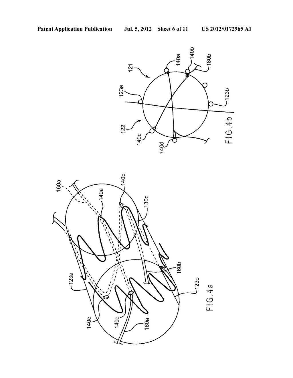 CONFORMABLE PROSTHESIS DELIVERY SYSTEM AND METHOD FOR DEPLOYMENT THEREOF - diagram, schematic, and image 07