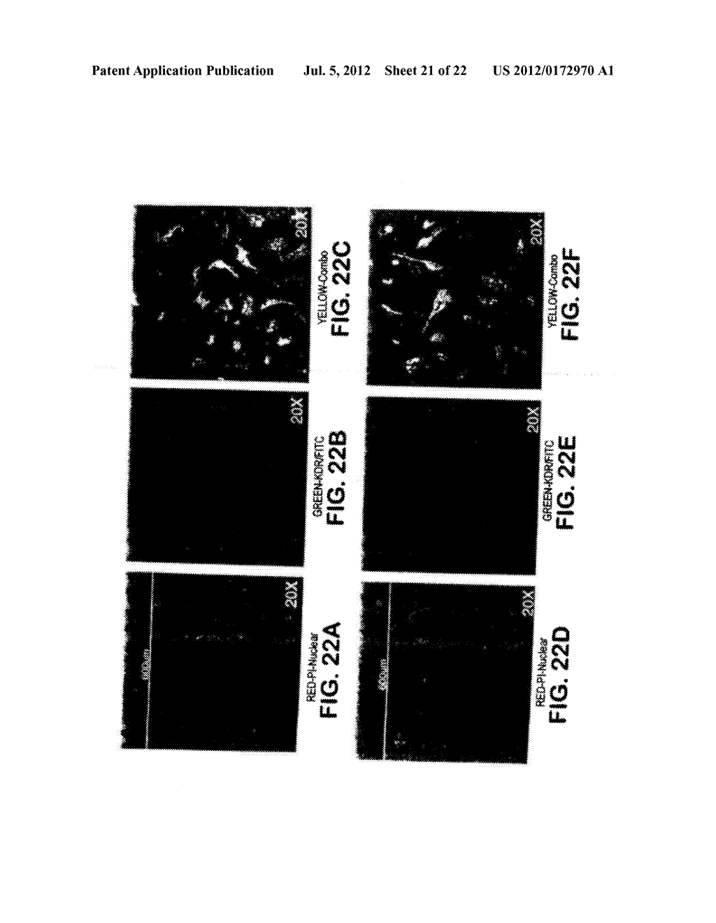 PROGENITOR ENDOTHELIAL CELL CAPTURING WITH A DRUG ELUTING IMPLANTABLE     MEDICAL DEVICE - diagram, schematic, and image 22