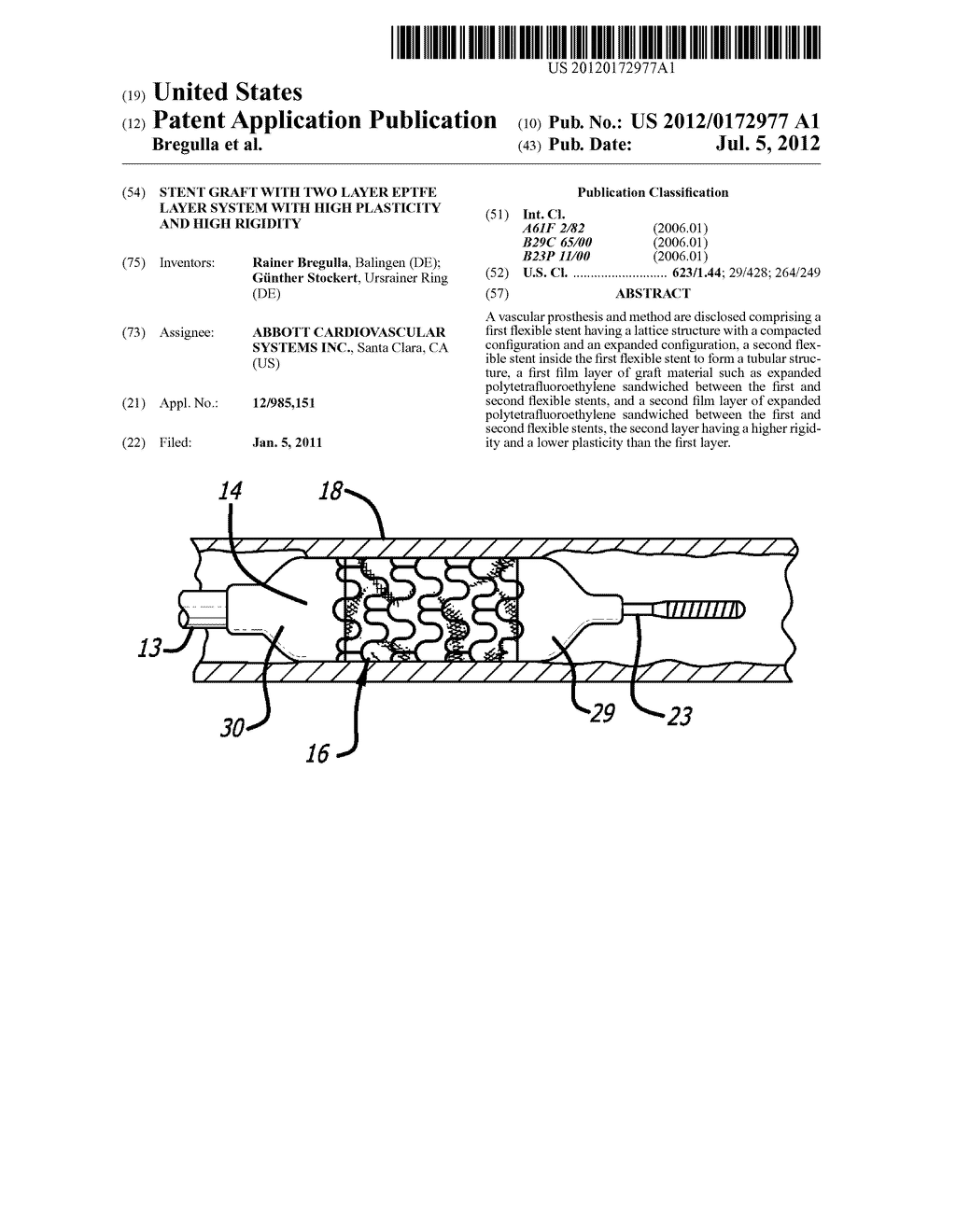 STENT GRAFT WITH TWO LAYER ePTFE LAYER SYSTEM WITH HIGH PLASTICITY AND     HIGH RIGIDITY - diagram, schematic, and image 01