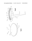 INTERVERTEBRAL IMPLANT WITH MULTIPLE RADII diagram and image