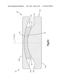 INTERVERTEBRAL IMPLANT WITH MULTIPLE RADII diagram and image