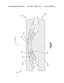 INTERVERTEBRAL IMPLANT WITH MULTIPLE RADII diagram and image