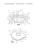 INTERVERTEBRAL IMPLANT WITH MULTIPLE RADII diagram and image