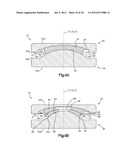 INTERVERTEBRAL IMPLANT WITH MULTIPLE RADII diagram and image