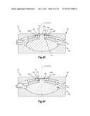 INTERVERTEBRAL IMPLANT WITH MULTIPLE RADII diagram and image