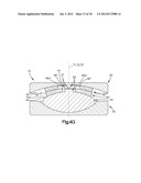 INTERVERTEBRAL IMPLANT WITH MULTIPLE RADII diagram and image