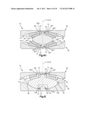 INTERVERTEBRAL IMPLANT WITH MULTIPLE RADII diagram and image