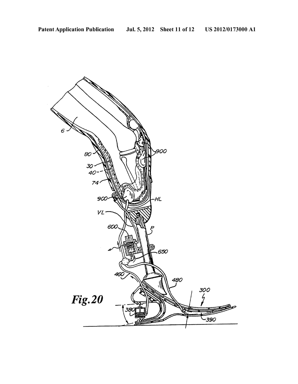 Dynamically Activated Variable Response Socket with Hydraulic Pump - diagram, schematic, and image 12