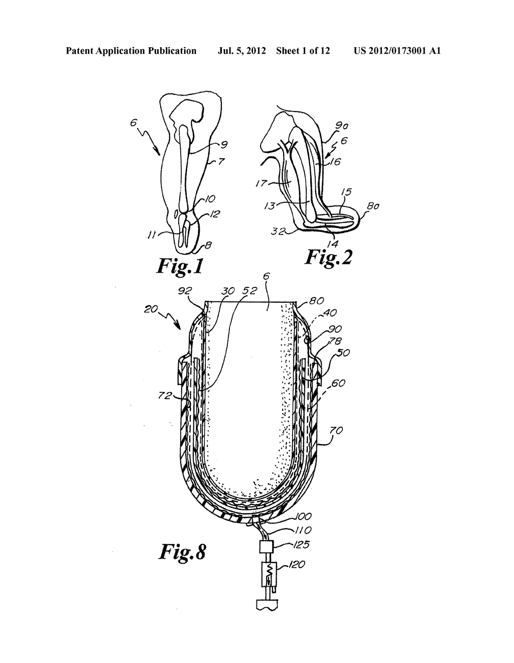 Dynamically Activated Variable Response Socket with Hydraulic Pump - diagram, schematic, and image 02