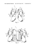 EXTREMITY ARMOR diagram and image