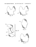 EXTREMITY ARMOR diagram and image