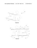 Dynamically Reactive Spinal Support System diagram and image