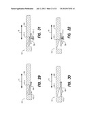 SURFACE CLEANING TOOLS HAVING END CAPS diagram and image