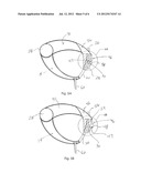 Gripping Zipper Securing Ring diagram and image