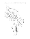 SLITTING TOOL diagram and image