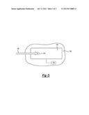 QUICK-RELEASE CAP WITH EJECTION RAMP diagram and image